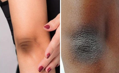 Aclarador y Iluminador con Vitamina C EQQUALBERRY