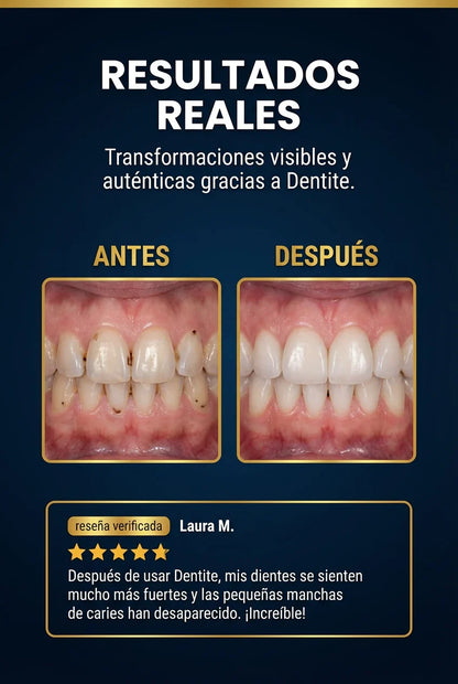 🌟 Reparador para el cuidado dental diario: ¡tu escudo para la salud bucal dondequiera que vayas! 🦷✨